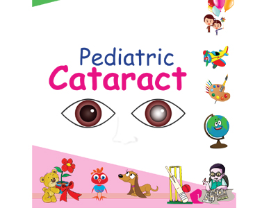 Pediatric Cataract