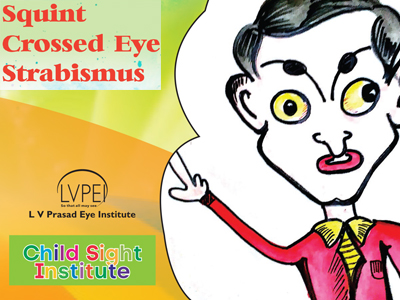 pediatric strabismus