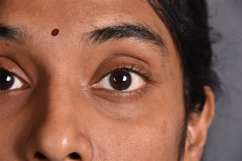 Dry Eye Disease