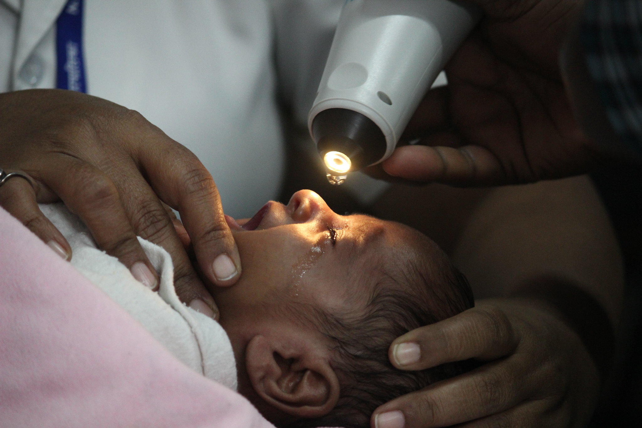 Baby screening ROP