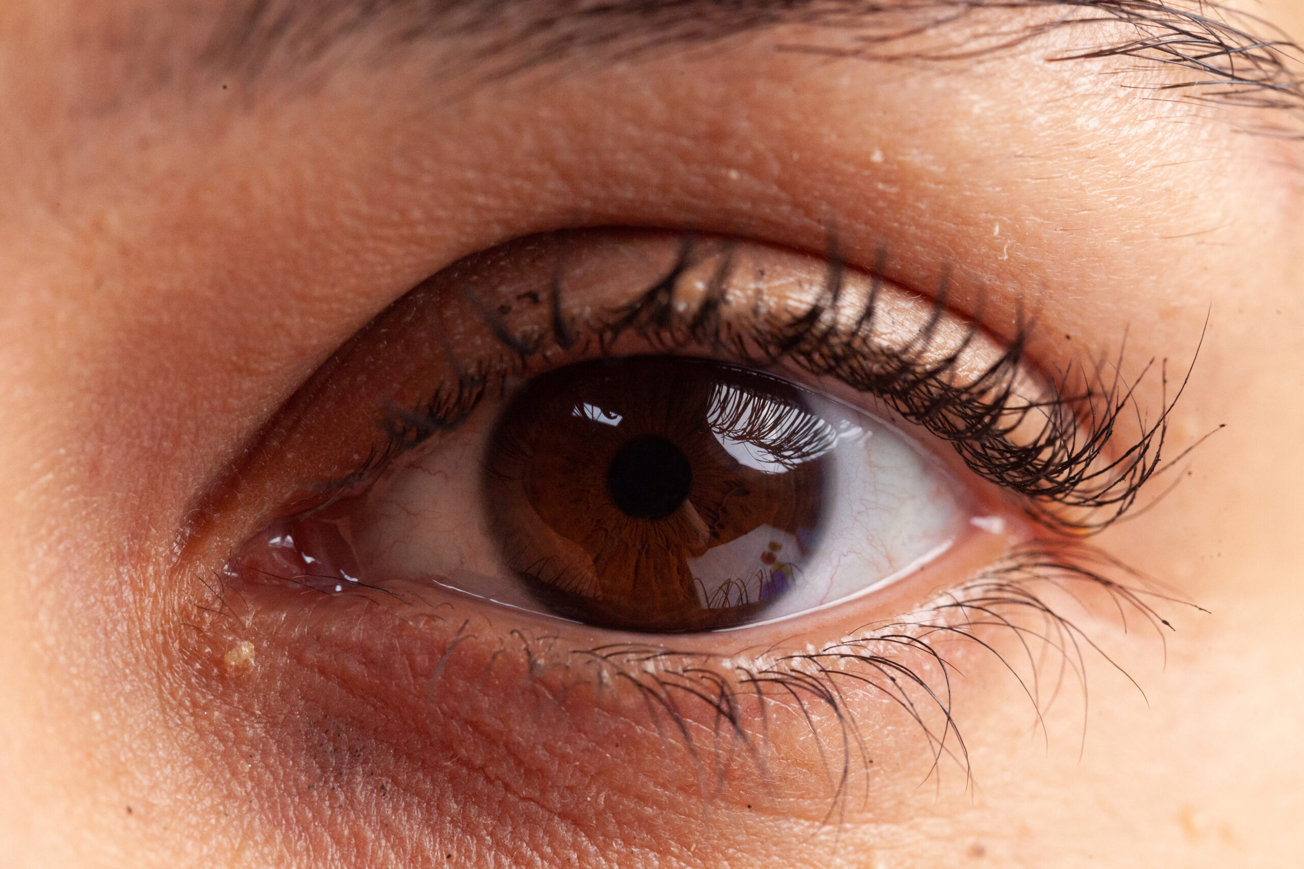 Color Blindness
