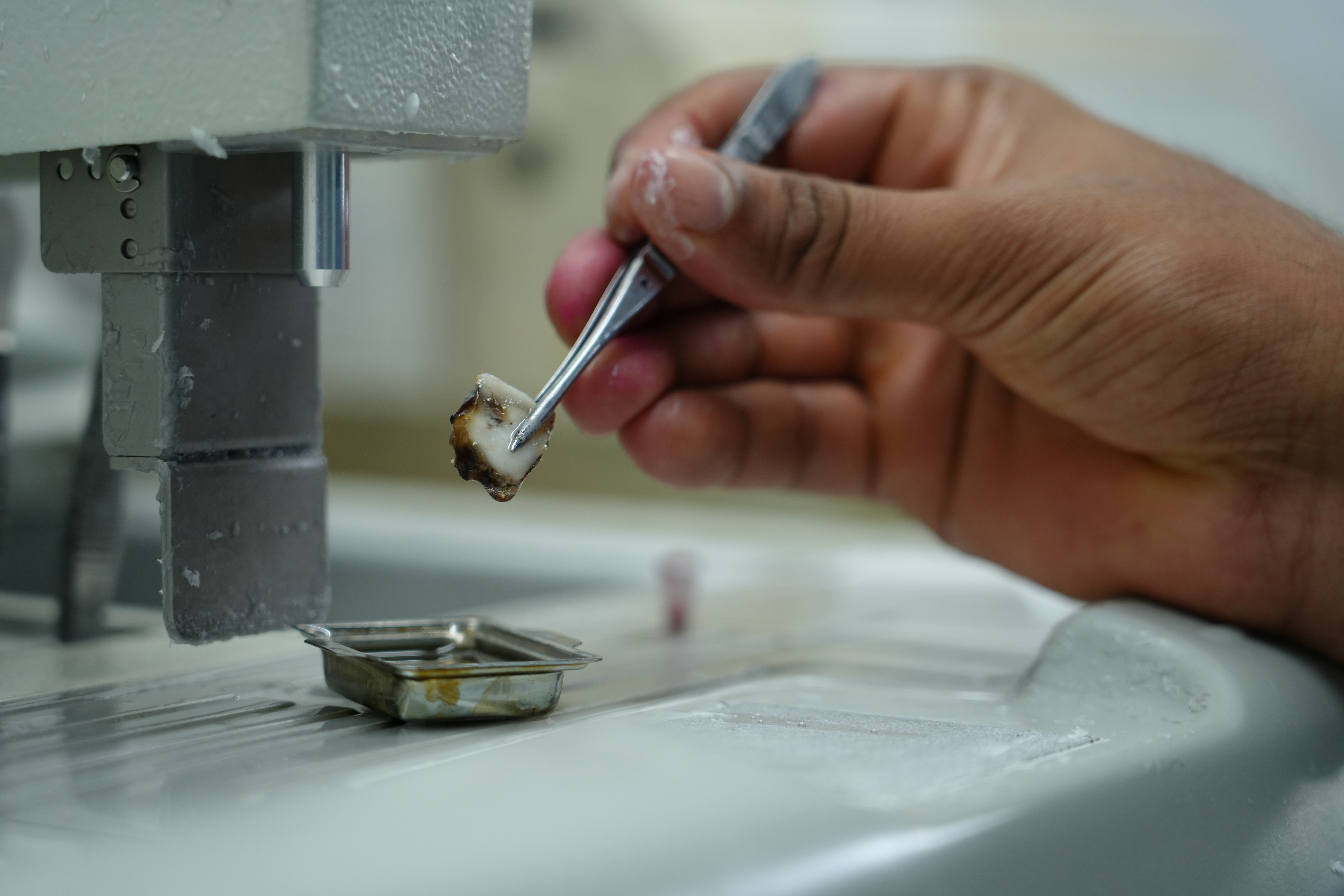 Pathology sample