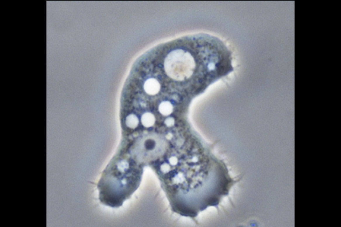 acanthamoeba