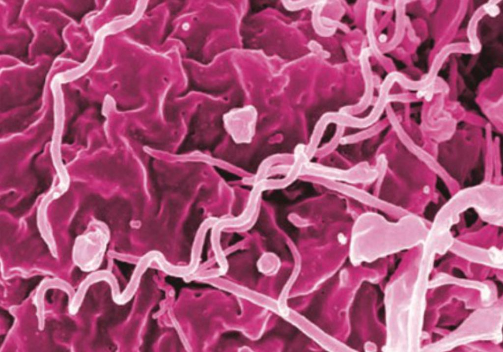 ocular syphilis