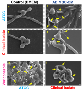 Microscopic images of a yeast after treatment with MSC-CM